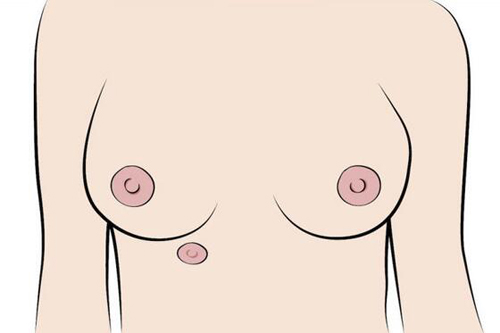 乳头形状有几种图片