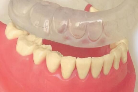 磨牙是什么原因引起的如何治疗?这五个因素造成及时改善