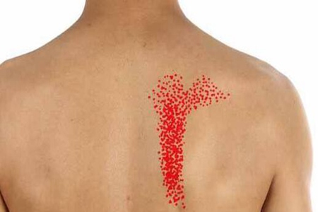 肩胛骨疼痛是什么原因引起的?这五个原因及时改善治疗