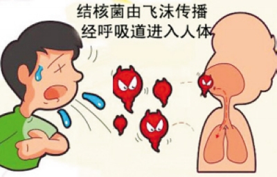 同学中有人得到结核病，我会不会被传染?