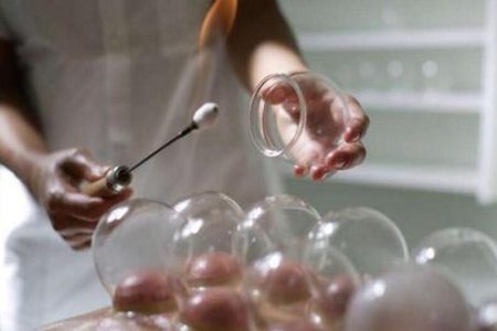 拔罐能去除体内湿气吗？这五种拔罐的好处和坏处