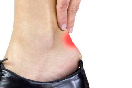 脚后跟疼怎么快速治好?这五个方法能缓解足跟痛