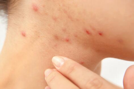 脖子上长个疙瘩是怎么回事?这五个原因情况可轻可重不可忽视