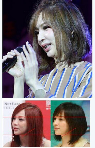 整容失败的明星谁最惨