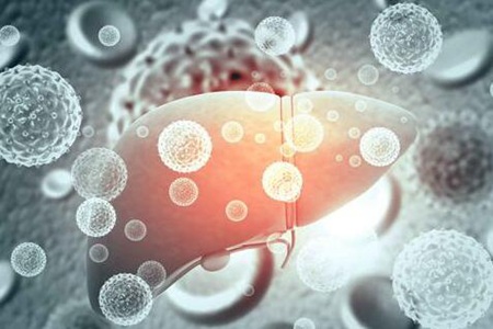 脂肪肝怎么才能减掉?(这五个方法慢慢消掉脂肪肝)