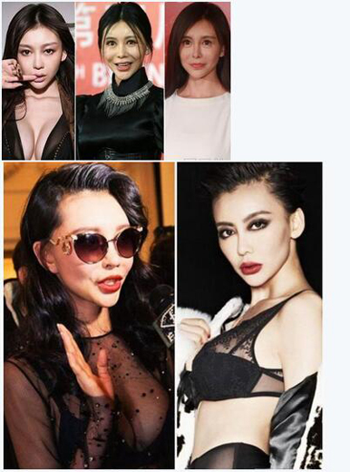 整容失败的明星谁最惨